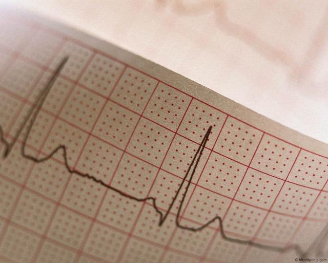 cardiograph.jpg